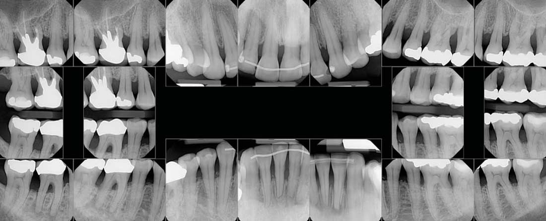 An x-ray of a case Dr. Richman has available fot the course