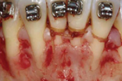 A case with before smile